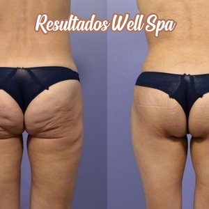 Tecnología corporal Wellspa