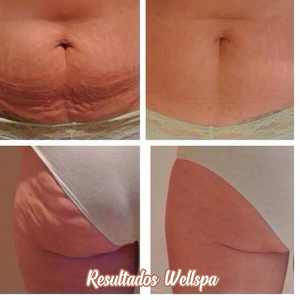 Tecnología corporal Wellspa