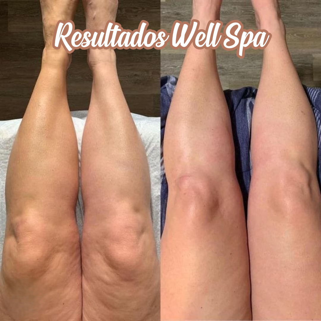 Tecnología corporal Wellspa